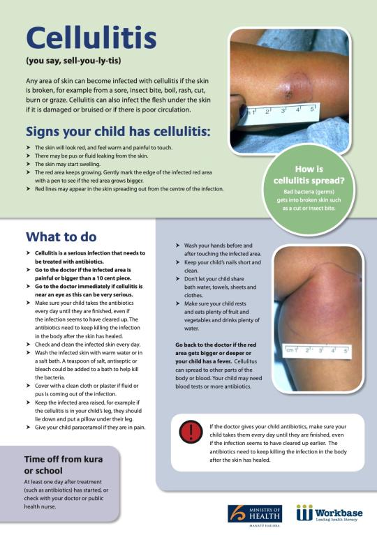 Cover of the cellulitis factsheet