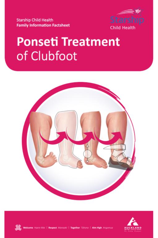 Ponseti treatment booklet cover