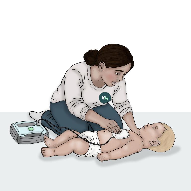 A woman places an AED pad on a baby’s bare chest. The AED is beside them, with a cable connecting it to the pad.