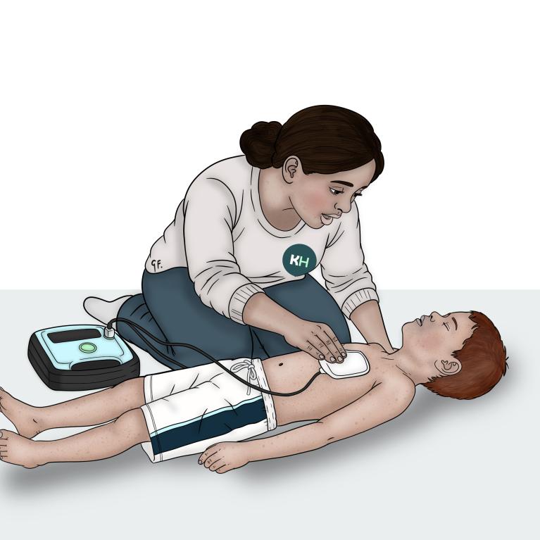 A woman places an AED pad on a child’s bare chest. The AED is beside them, with a cable connecting it to the pad.