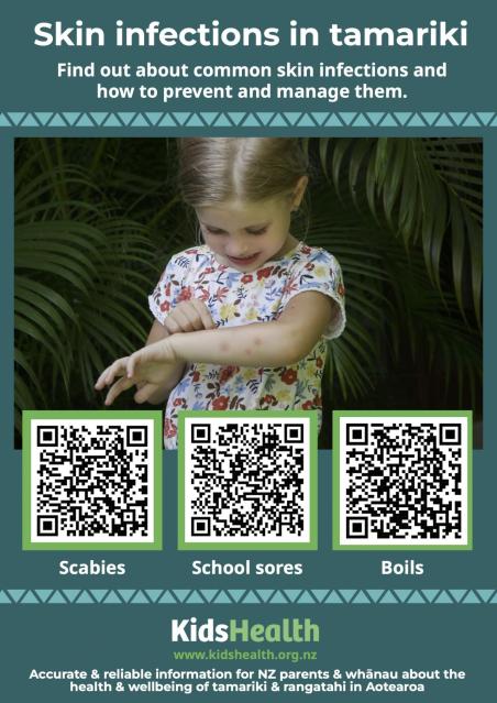An educational health poster about skin infections in children with three QR codes below labelled 'Scabies', 'School sores', and 'Boils', from the KidsHealth New Zealand website.