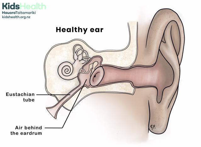 An illustration of a healthy ear showing eustachian tube and normal middle ear