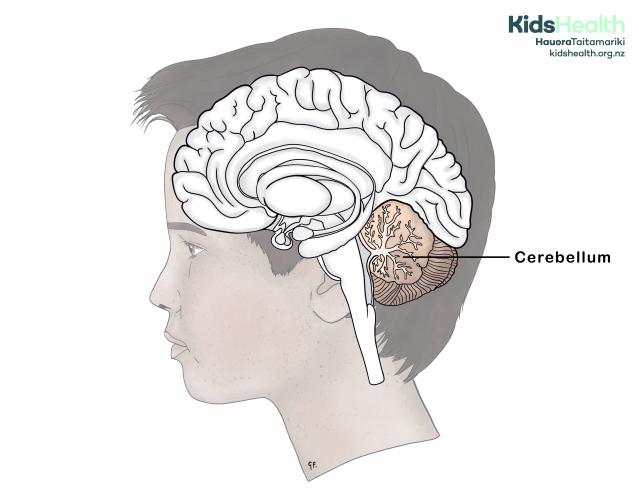 An illustration of the side view of a young person’s head showing the brain in cross-section with the cerebellum highlighted and labelled.
