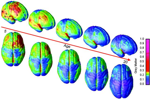 A series of brain scans from ages 5 to 20 showing colour changes that reflect brain development over time. The colour shifts from red/yellow/green to blue as the brain matures.