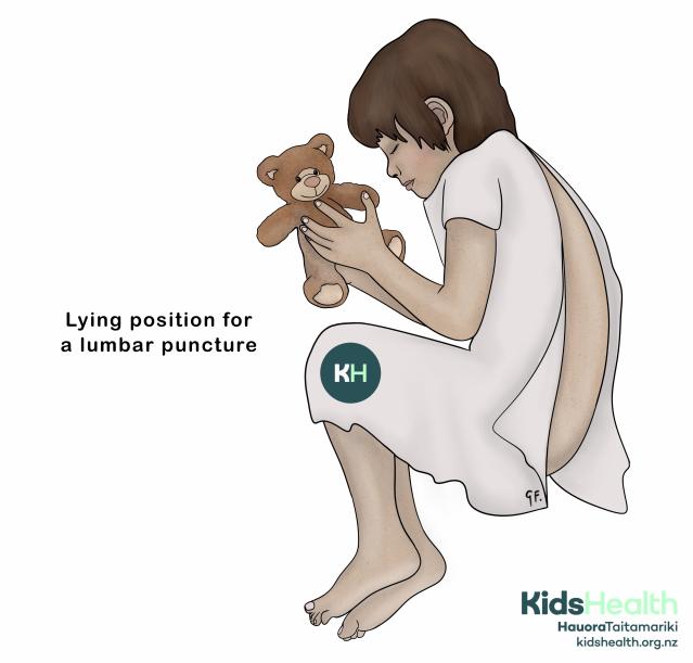 An illustration of a child curled up on their side holding a teddy bear, showing a common lying position for a lumbar puncture.