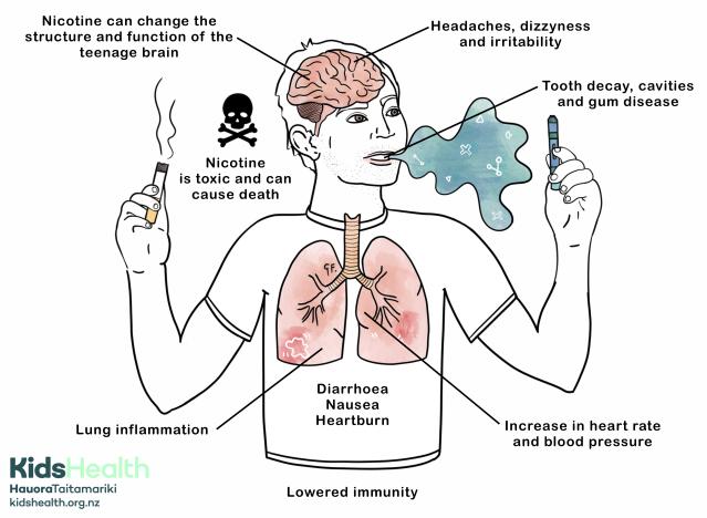 Infographic Illustration showing the harmful effects of nicotine and vaping on different parts of the body.