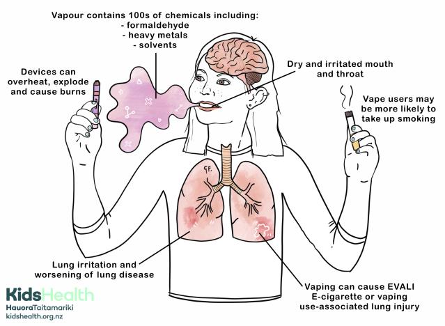 Infographic illustration showing the harmful effects of vaping in young people.