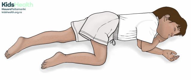 Illustration showing child in the recovery position