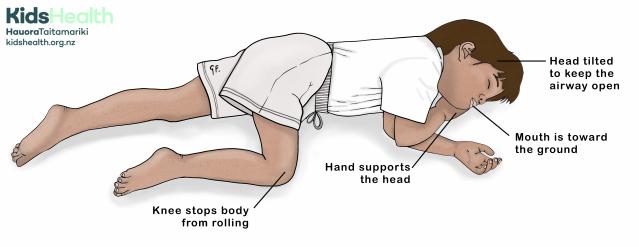 An illustration of a child in the recovery position, lying on their side. Labels point to the head tilted to keep the airway open, the mouth facing the ground, the hand supporting the head, and the knee preventing the body from rolling.