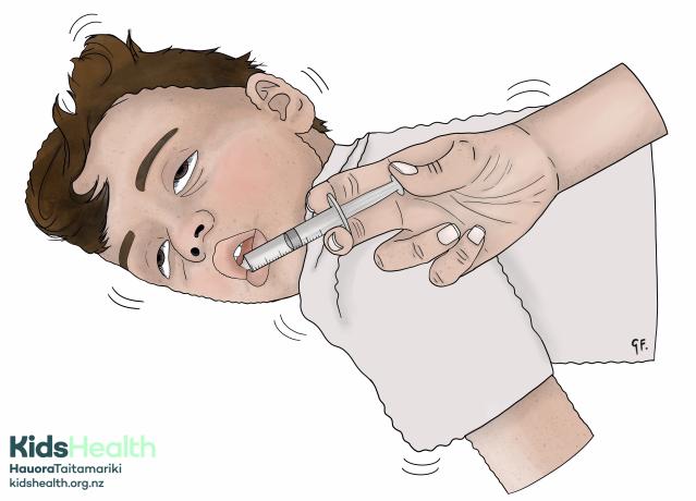An illustration showing a child lying on their side having a seizure while medicine is given into their cheek using a syringe.