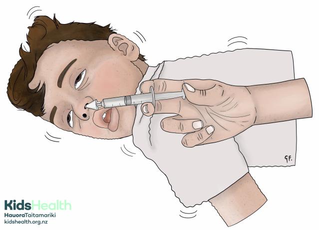 An illustration showing a child lying on their side having a seizure while medicine is given into their nose using a syringe with a nasal adaptor.