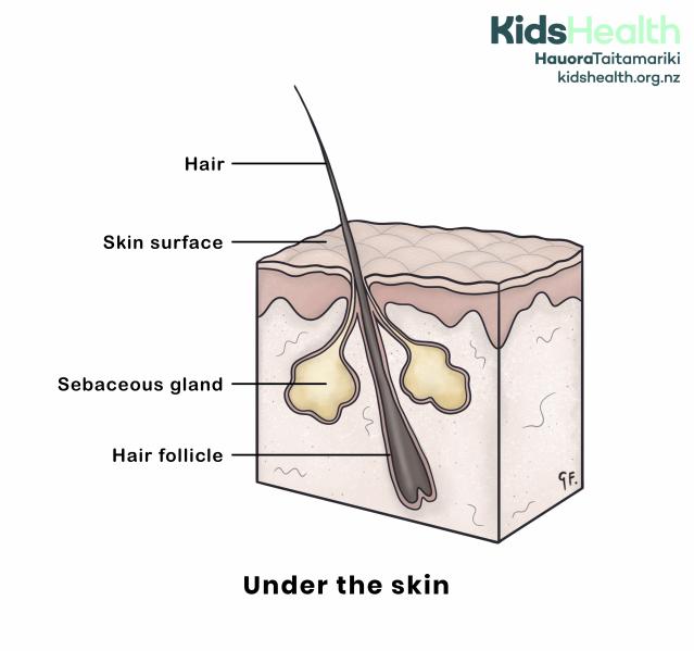 An illustration of skin in cross-section showing a hair follicle, sebaceous gland, and the skin surface. Labels point to the hair, skin surface, sebaceous gland, and hair follicle.
