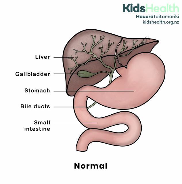 An illustration showing a healthy liver, gallbladder, stomach, bile ducts, and small intestine. The bile ducts connect the liver and gallbladder to the small intestine.