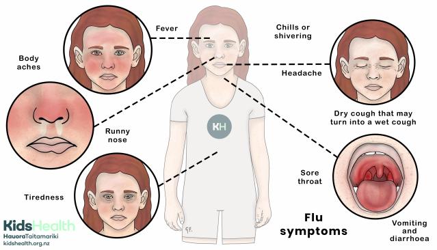 An illustration showing flu symptoms including fever, chills, headache, runny nose, cough, sore throat, vomiting, diarrhoea, body aches, and tiredness.