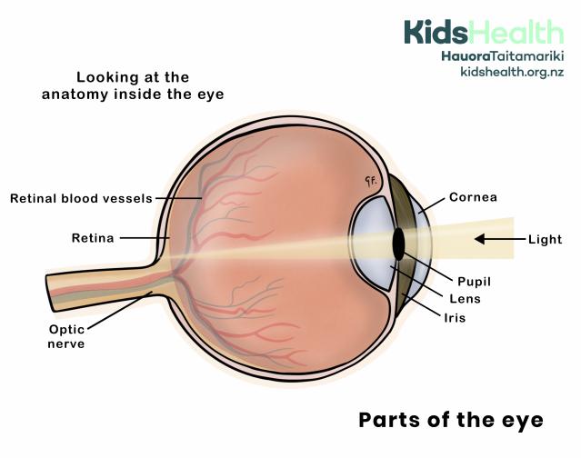 Cross-section of the eye showing the main parts of the eye, including the cornea, iris, pupil, lens, retina, retinal blood vessels and optic nerve. Arrows show light entering the eye through the pupil.