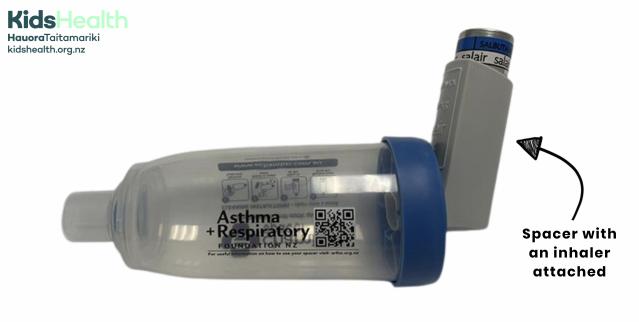 A photo showing an inhaler attached to a spacer.