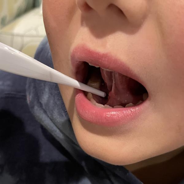 Photo showing a thermometer in a child's mouth