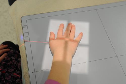 Photo of an xray board with a childs hand on it