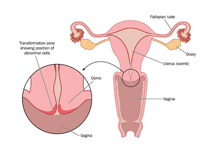 will an mri show colon polyps