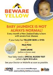 Thumbnail image of 'Beware yellow' poster