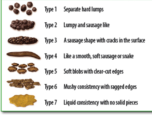 Bristol stool chart showing different types of poo