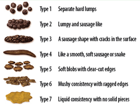 Bristol stool chart showing different types of poo