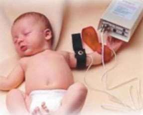 Photo of a baby having a sweat test