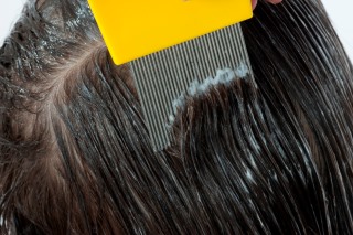 Using a fine tooth head lice comb