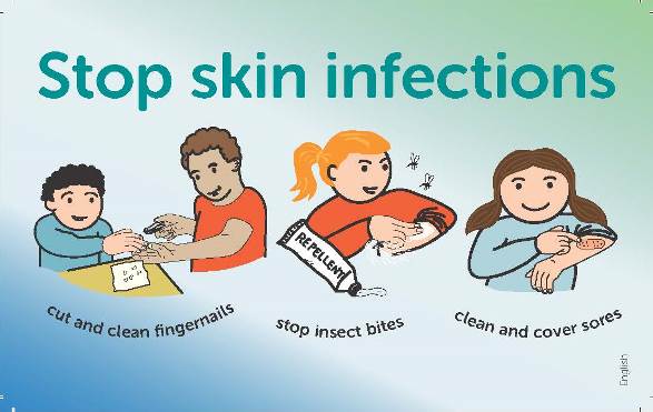 Graphics showing various ways of stopping skin infections 