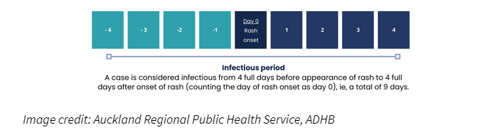 Image showing infectious period for measles