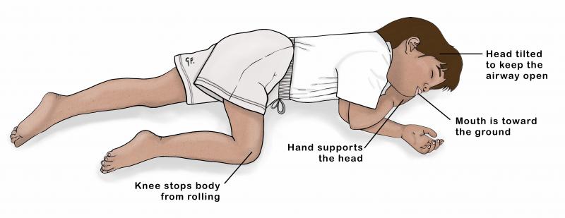 Illustration of a child in the recovery position
