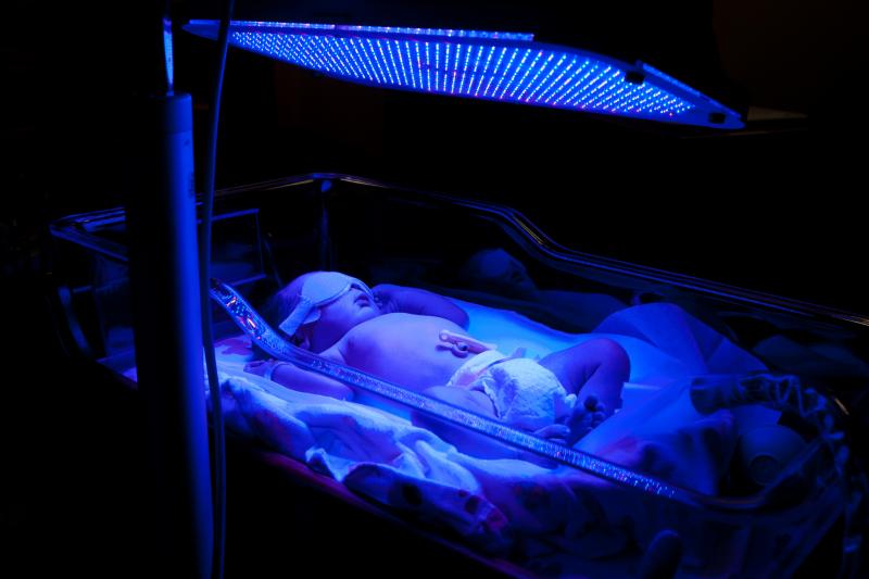 Image of baby receiving phototherapy (bright light therapy)