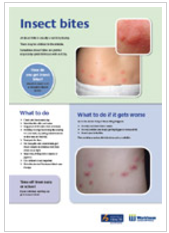 Insect Bites What To Do About Them In Children Kidshealth Nz