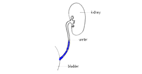 A diagram of the kidney