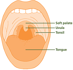 Diagram of tonsils